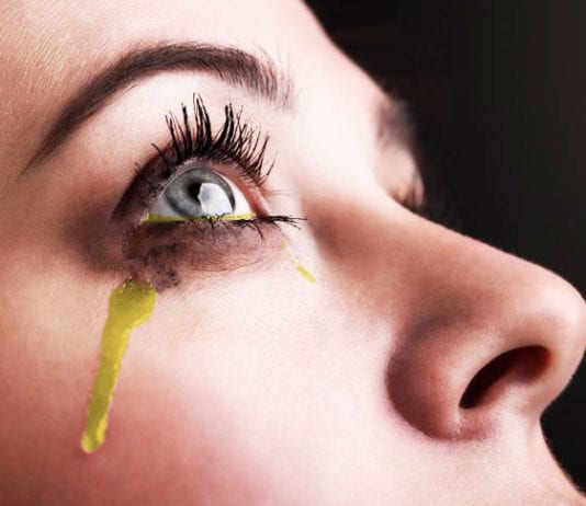 After Being Given 200 mg of IV Lasix, Patient Urinating from Eyeballs urine urinating eyeballs