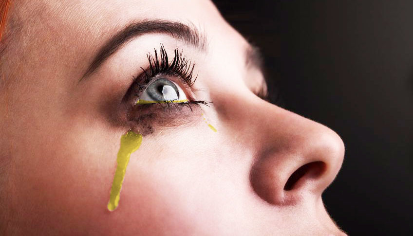After Being Given 200 mg of IV Lasix, Patient Urinating from Eyeballs