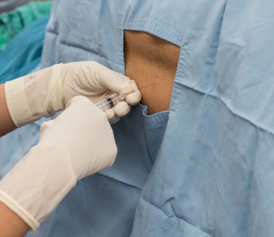 Regional Anesthesiologist Master of the Cock Block