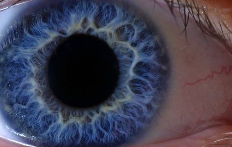 eyeball retina