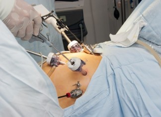 Flatulence to Blame for Failed Laparoscopic Procedure Laparoscopic surgery