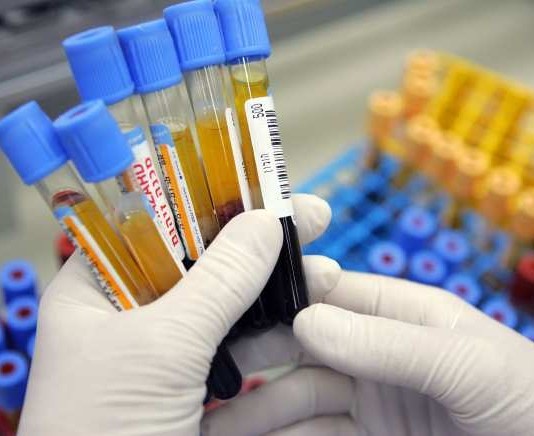 Local Woman: ‘I Need All My Labs Drawn’ lab tests