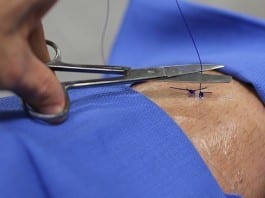 Breaking: Medical Student Cuts Surgical Knot Too Short