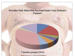 What Did You Find Under Your Patient’s Pannus? pannus reduction
