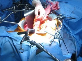 Mass General to Offer New Residency in Retractor Holding