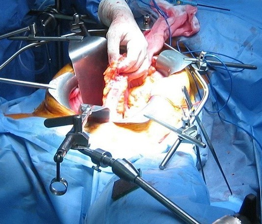 Mass General to Offer New Residency in Retractor Holding