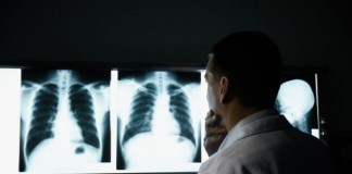 Radiology Intern Already Unable to Completely Exclude Any Diagnosis radiologist
