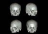 3D Head CT: The New Ultimate Selfie head ct
