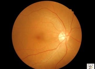 NASA: New Planet Discovered with Equatorial Volcano and Rivers of Lava new planet