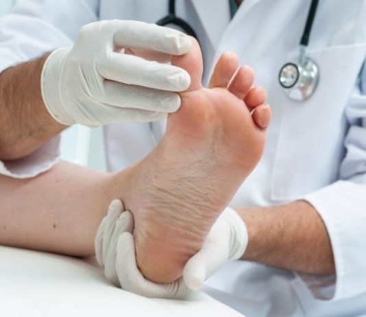 Rivalry Between Family Practitioner and Podiatrist Linked Back to One Case of Foot Fungus athlete's foot