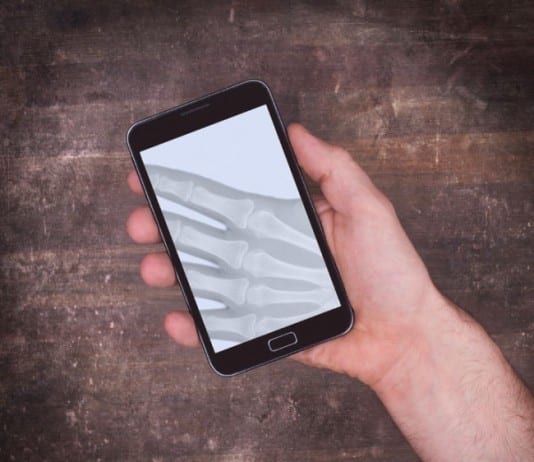 New Smartphone App + Selfie Stick Allows Patients to Take Own X-Rays at Home xray smartphone app