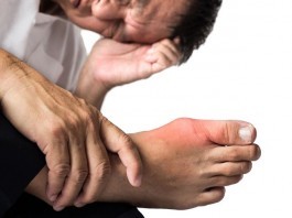 Patient Continues to Insist He Suffers from “The Gouch,” Not Gout gout