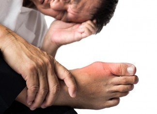 Patient Continues to Insist He Suffers from “The Gouch,” Not Gout gout