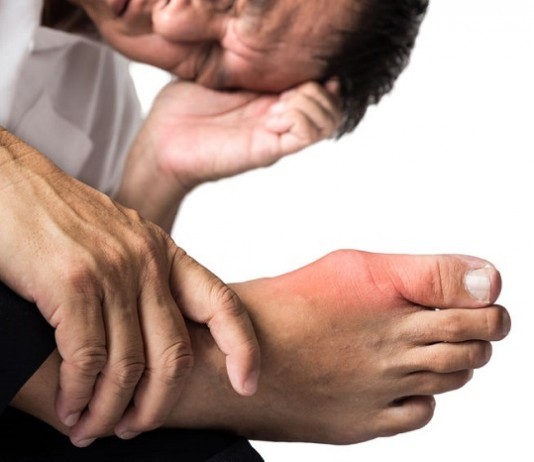 Patient Continues to Insist He Suffers from “The Gouch,” Not Gout gout