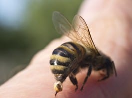 Bee Sting Therapy Administered Despite Bee Sting Allergy Clearly Documented by Nursing bee sting allergy