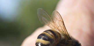 Bee Sting Therapy Administered Despite Bee Sting Allergy Clearly Documented by Nursing bee sting allergy