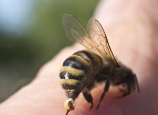 Bee Sting Therapy Administered Despite Bee Sting Allergy Clearly Documented by Nursing bee sting allergy