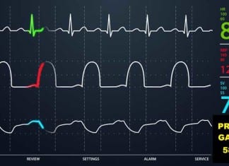 Brand New Vital Sign Added to Monitors and Electronic Medical Records vital sign monitor