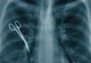 New Year’s Resolution: Hospital Moving Away from Term “Never Event”… Due to Frequency of Events never event medical error