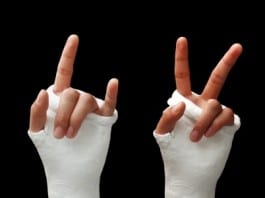 Some Lovers Try Positions That They Can’t Handle, Break Hand Bones in Process