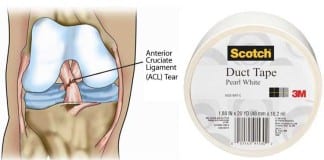 Orthopedic Surgeon Arrested for Using Duct Tape to Repair ACLs acl knee