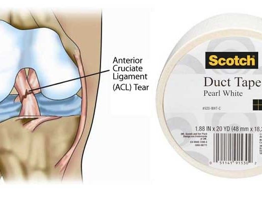 Orthopedic Surgeon Arrested for Using Duct Tape to Repair ACLs acl knee