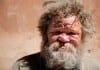 Industrious Homeless Man Creates Hospital Room-Share Website