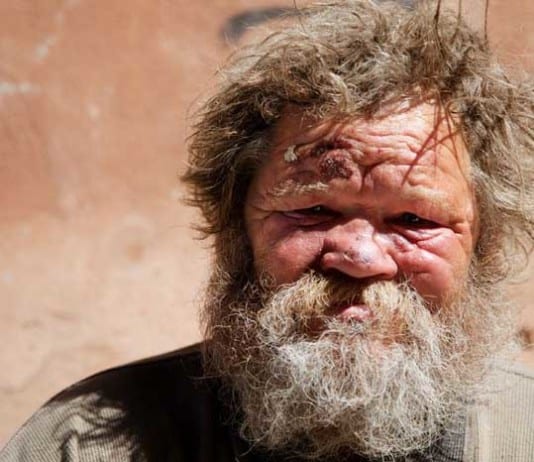 Industrious Homeless Man Creates Hospital Room-Share Website