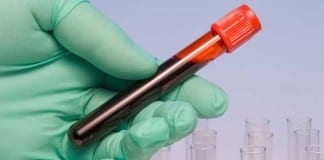 Skilled Phlebotomist Draws Blood from Aorta aorta