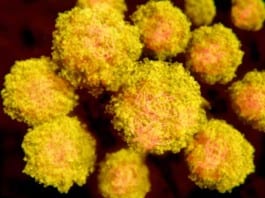 Weakened HIV No Longer Worthy of Own Chapter in Medical Textbook zika virus