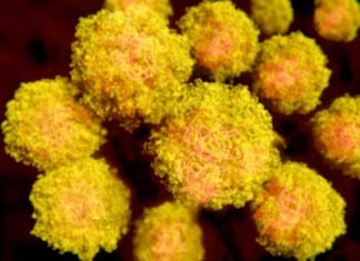 Weakened HIV No Longer Worthy of Own Chapter in Medical Textbook zika virus