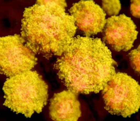 Weakened HIV No Longer Worthy of Own Chapter in Medical Textbook zika virus