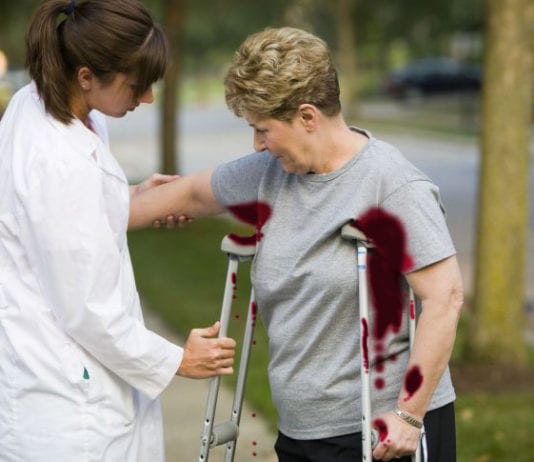 Woman Not Sure if She’s Using Crutches Correctly bloody armpits, bleeding armpits