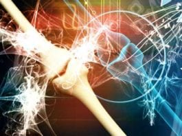 Avascular Necrosis Renamed to Slow Chronic Unfixable Bone Atrophy (SCUBA) to Stop Unnecessary STAT Consults avascular necrosis