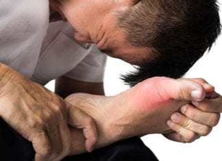Area Emergency Physician Successfully Manages Gout Without Consultation gout