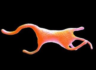 Single-Celled Organism Caught Masquerading as VA ICU Nurse amoeba