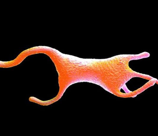 Single-Celled Organism Caught Masquerading as VA ICU Nurse amoeba