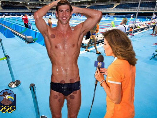 Michael Phelps Has a Few Too Many Cupping Marks Near Genitals