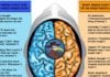 The Left & Right Hemispheres of an Anesthesiologist brain hemispheres anesthesiologist