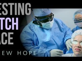 Resting Bitch Face Treatment