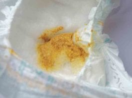 The Difference Between Sharting & Charting sharting