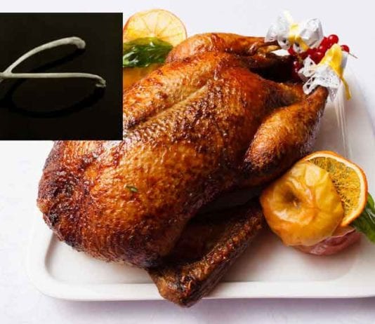 Ortho Consulted to Repair Broken Wishbone wishbone