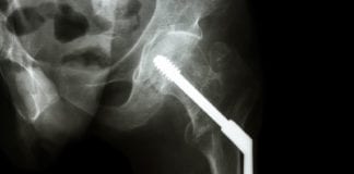 Ortho Consults Medicine for Surgical Management surgical management