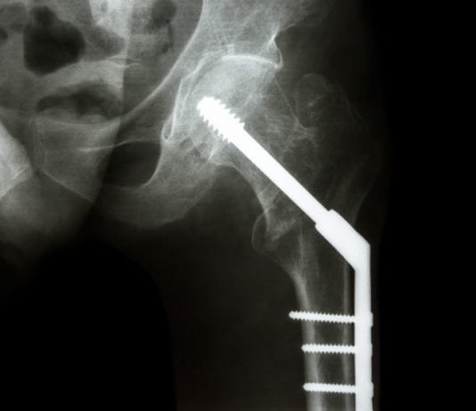 Ortho Consults Medicine for Surgical Management surgical management