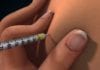 New Narcan Reversal Agent, NarCANT, Hits the Market injection
