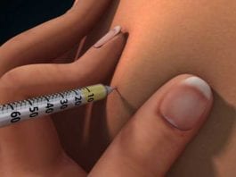 New Narcan Reversal Agent, NarCANT, Hits the Market injection