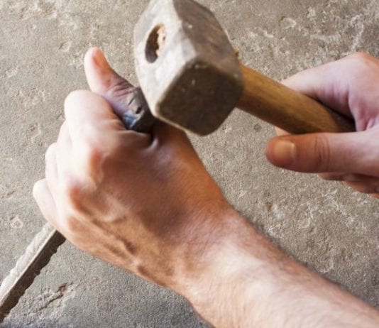 New Stone & Chisel Medical Record a Huge Pain in the Ass stone & chisel