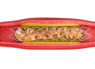 Cardiologists Now Deploying Bacon-Eluting Stents bacon-eluting stent