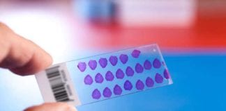 Pathology Slide Fills Out Poor Satisfaction Survey About Pathologist pathology slide