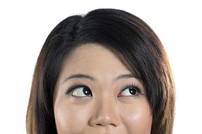 Breaking News: Nurse’s Eyes Get Stuck After Aggressive Eye Roll